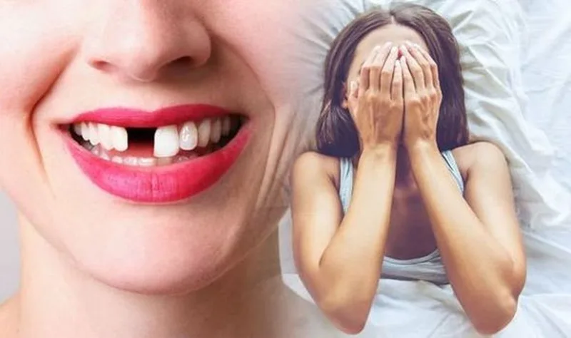 Giấc mơ thấy rụng răng không chảy máu mang lại cảm giác lo lắng mơ hồ cho nhiều người khi thức dậy.