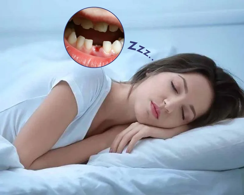 Văn hóa phương Đông coi giấc mộng rụng răng không chảy máu là điềm lành về công việc và tài lộc.